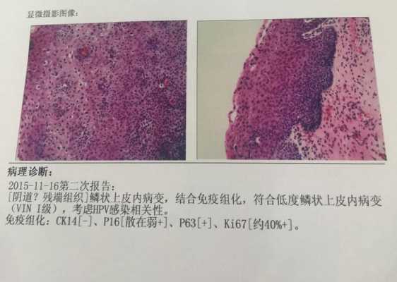 免疫组化ap检查什么意思（免疫组化ap十是什么意思）