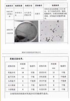 什么是药敏试验（做药敏试验多少钱一次）