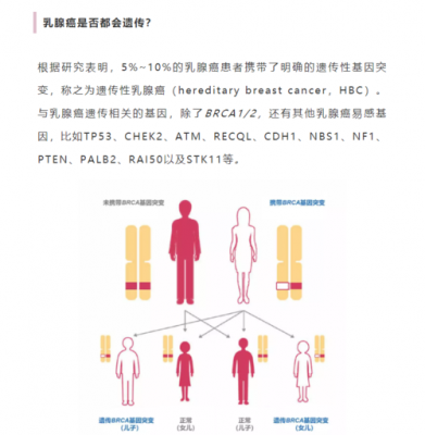 BRC是什么病（brca医学上是什么意思）