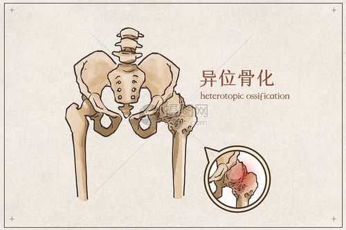 骨化物是什么（骨化的两种形式）