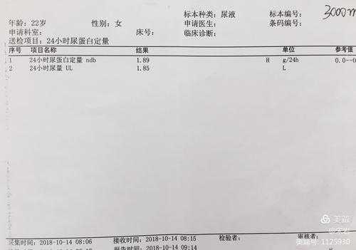 尿坏血酸2是什么意思（尿扛坏血酸增高）