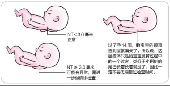 化工nt是什么意思（化工ln是什么意思）