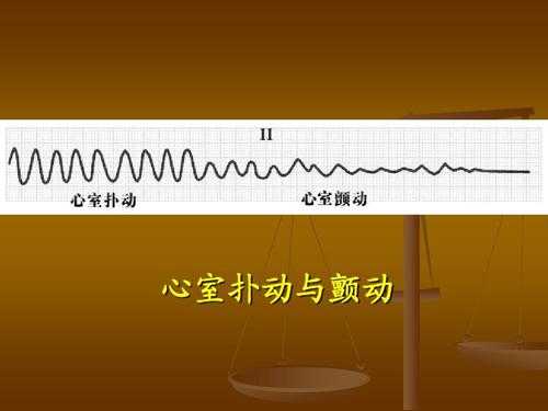 心室反应什么意思（心室反位什么意思）